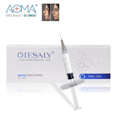 OTESALY 2ML Hyaluronic Acid dermal filler with Lido for Nasolabial Folds Cheek Contours